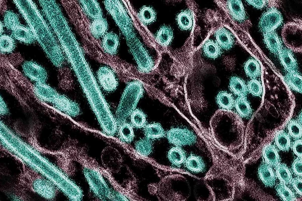 El virus de la gripe aviar H5N1 y el ganado vacuno lechero: ¿un peligro real y actual?